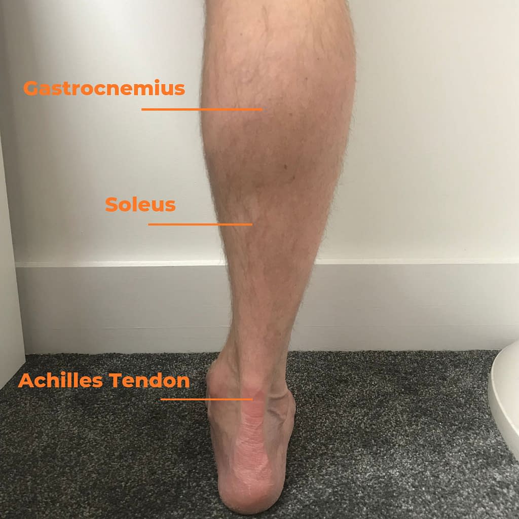 Managing And Resolving Achilles Pain | Complete Endurance Running